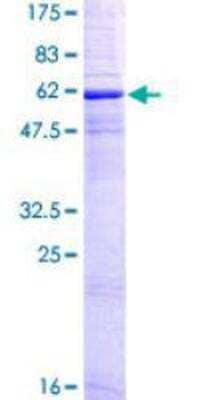 SDS-PAGE: Recombinant Human CD20 GST (N-Term) Protein [H00000931-P01]