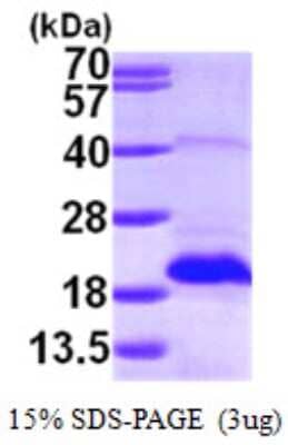 SDS-PAGE: Recombinant Human MSRB2 His Protein [NBP1-50897]