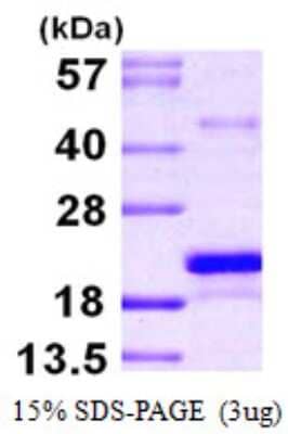 SDS-PAGE: Recombinant Human MSRB3 His Protein [NBP1-51024]