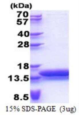 SDS-PAGE: Recombinant Human MTCP1 His Protein [NBP2-23218]