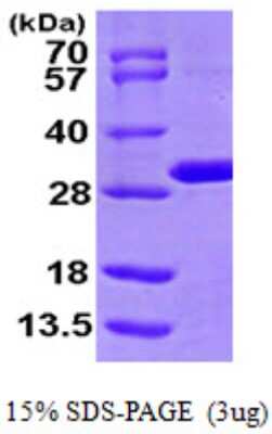 SDS-PAGE: Recombinant Human MTHFS His Protein [NBP1-51046]