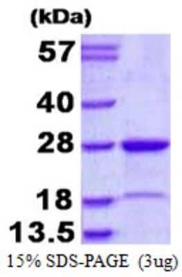 SDS-PAGE: Recombinant Human MUTED His Protein [NBP1-98901]