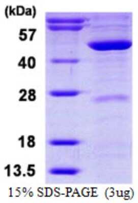 SDS-PAGE: Recombinant Human MVD His Protein [NBP1-78853]