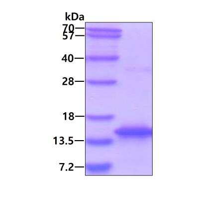 SDS-PAGE: Recombinant Human MYCBP His Protein [NBP1-72468]