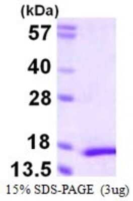 SDS-PAGE: Recombinant Human MYL5 His Protein [NBP1-72432]