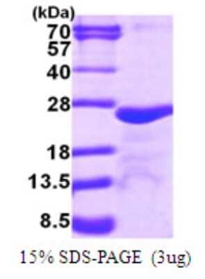 SDS-PAGE: Recombinant Human MYL5 His Protein [NBP1-72469]