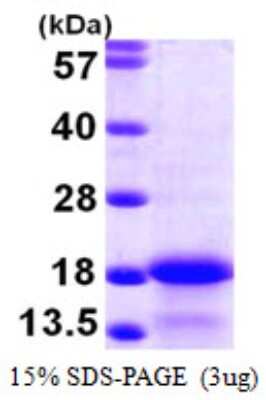 SDS-PAGE: Recombinant Human MYL6 His Protein [NBP1-51029]