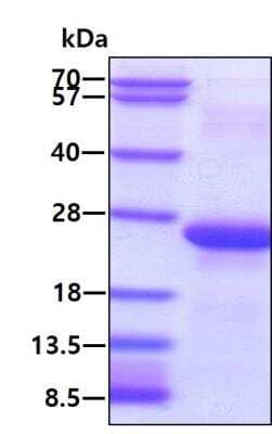 SDS-PAGE: Recombinant Human MYL7 His Protein [NBP1-98977]