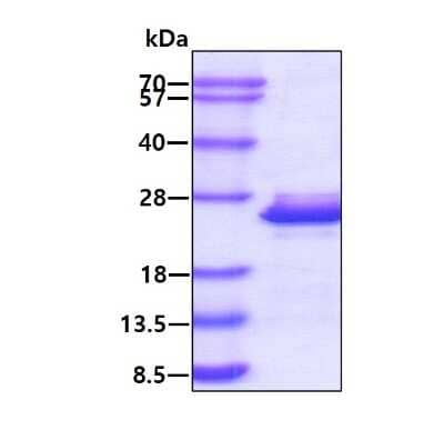 SDS-PAGE: Recombinant Human MYL9 His Protein [NBP1-51000]