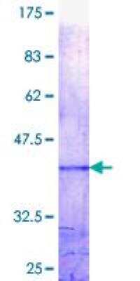 SDS-PAGE: Recombinant Human Mad GST (N-Term) Protein [H00004084-Q01]