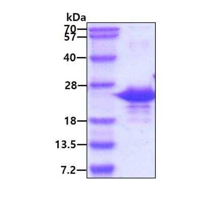 SDS-PAGE: Recombinant Human MafG His Protein [NBP1-72507]