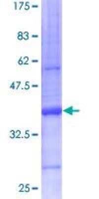 SDS-PAGE: Recombinant Human Mammaglobin A GST (N-Term) Protein [H00004250-P01]