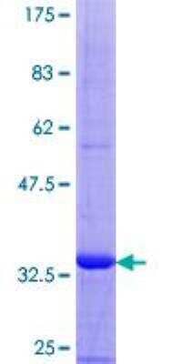 SDS-PAGE: Recombinant Human Mammaglobin B GST (N-Term) Protein [H00004246-P01]