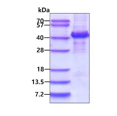 SDS-PAGE: Recombinant Human Mannose Phosphate Isomerase His Protein [NBP1-72436]