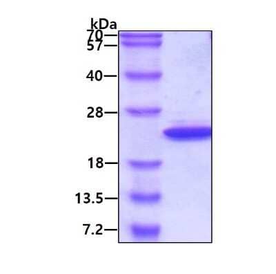 SDS-PAGE: Recombinant Human Max His Protein [NBP1-44497]