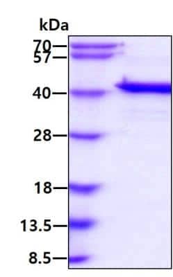 SDS-PAGE: Recombinant Human Mcl-1 His Protein [NBP2-51510]