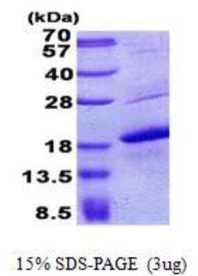 SDS-PAGE: Recombinant Human Melan-A/MART-1 His Protein [NBP2-23223]