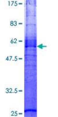 SDS-PAGE: Recombinant Human Melanocortin-3 R/MC3R GST (N-Term) Protein [H00004159-P01]