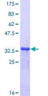 SDS-PAGE: Recombinant Human Metallothionein-1A GST (N-Term) Protein [H00004489-P01]