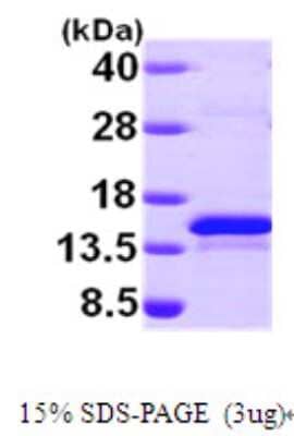 SDS-PAGE: Recombinant Human Methionine Sulfoxide Reductase B His Protein [NBP1-49302]