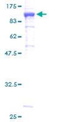 SDS-PAGE: Recombinant Human Methylmalonyl Coenzyme A mutase GST (N-Term) Protein [H00004594-P01]