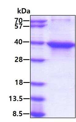 SDS-PAGE: Recombinant Human Musashi-2 His Protein [NBP2-23252]