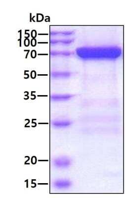 SDS-PAGE: Recombinant Human MxA/Mx1 His Protein [NBP2-51838]