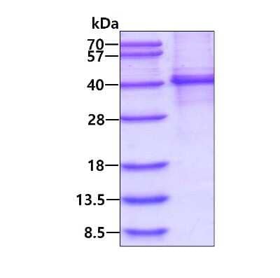 SDS-PAGE: Recombinant Human MyD88 His Protein [NBP2-23255]