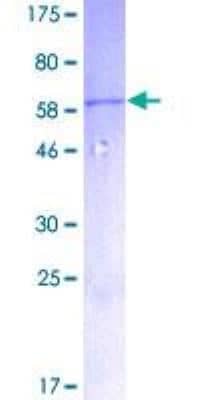 SDS-PAGE: Recombinant Human MyD88 GST (N-Term) Protein [H00004615-P01]