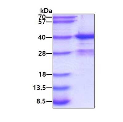 SDS-PAGE: Recombinant Human Myeloid leukemia factor 1 His Protein [NBP1-50985]