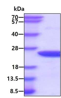 SDS-PAGE: Recombinant Human Myosin Light Chain 2 His Protein [NBC1-18536]