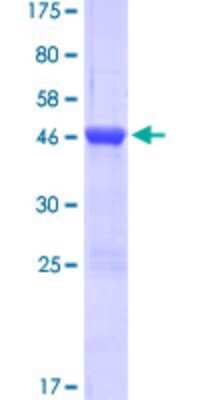 SDS-PAGE: Recombinant Human Myosin light chain kinase GST (N-Term) Protein [H00004638-P02]