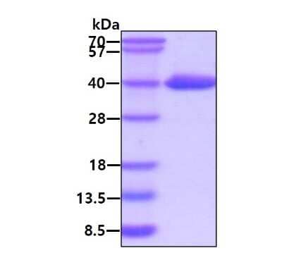 SDS-PAGE: Recombinant Human N-Acetyl-D-Glucosamine Kinase/NAGK His Protein [NBP1-99050]