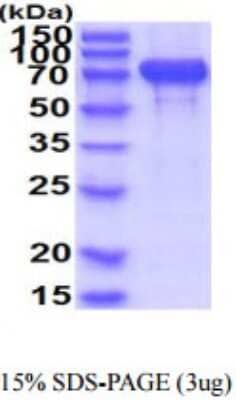 SDS-PAGE: Recombinant Human N-Cadherin His Protein [NBP2-59927]