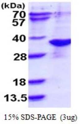 SDS-PAGE: Recombinant Human NAA10 His Protein [NBP1-72403]