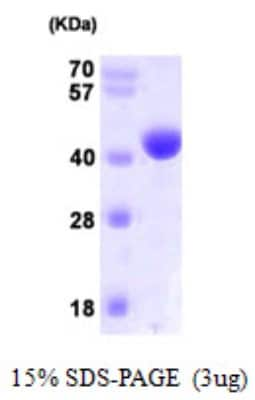 SDS-PAGE: Recombinant Human NANS His Protein [NBP1-50870]