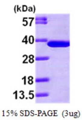 SDS-PAGE: Recombinant Human NAPA His Protein [NBP1-48365]