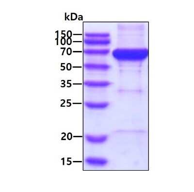 SDS-PAGE: Recombinant Human NARS His Protein [NBP2-52159]