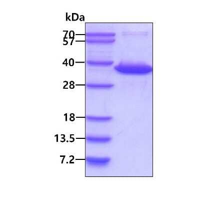 SDS-PAGE: Recombinant Human NAT1 His Protein [NBP1-72356]