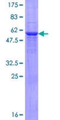 SDS-PAGE: Recombinant Human NAT2 GST (N-Term) Protein [H00000010-P02]