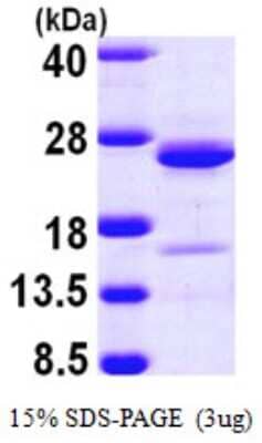 SDS-PAGE: Recombinant Human NCALD His Protein [NBP1-50975]