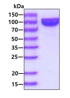 SDS-PAGE: Recombinant Human NCAM-1/CD56 His Protein [NBP3-07122]