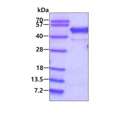 SDS-PAGE: Recombinant Human NCF1 His Protein [NBP1-45305]