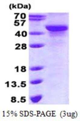 SDS-PAGE: Recombinant Human NDRG2 His Protein [NBP2-23273]