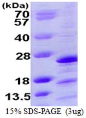 SDS-PAGE: Recombinant Human NDUFAF2 His Protein [NBP1-72379]