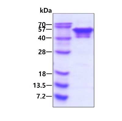 SDS-PAGE: Recombinant Human NEIL1 His Protein [NBP1-78846]