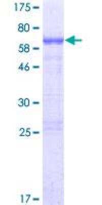 SDS-PAGE: Recombinant Human NHLRC2 GST (N-Term) Protein [H00374354-P01]