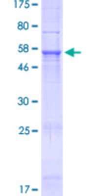 SDS-PAGE: Recombinant Human NHLRC3 GST (N-Term) Protein [H00387921-P01]