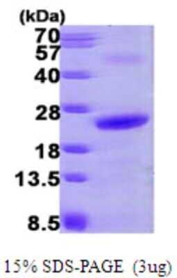 SDS-PAGE: Recombinant Human NHP2 His Protein [NBP1-50949]