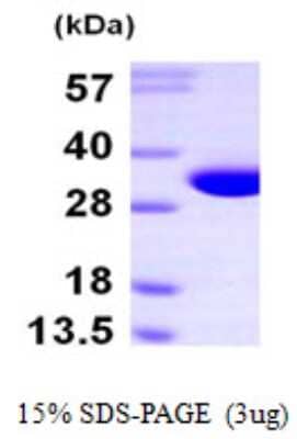 SDS-PAGE: Recombinant Human NIT2 His Protein [NBP1-50903]